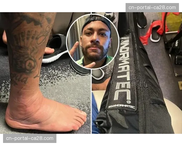 巴西队医确认:内马尔脚踝伤势无大碍,不会影响俱乐部赛事 巴西队医确认:内马尔脚踝伤势无大碍,不会影响俱乐部赛事